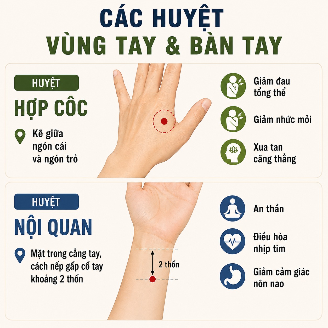 Các huyệt vùng tay và bàn tay